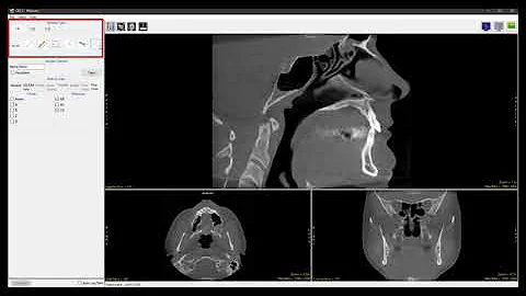 Analyze 14.0 - Measure: Sample Perpendicular Lines