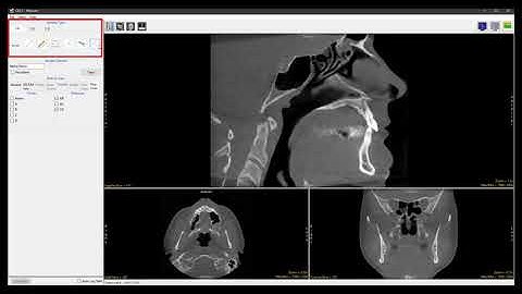 Analyze 14.0 - Measure: Sample Perpendicular Lines