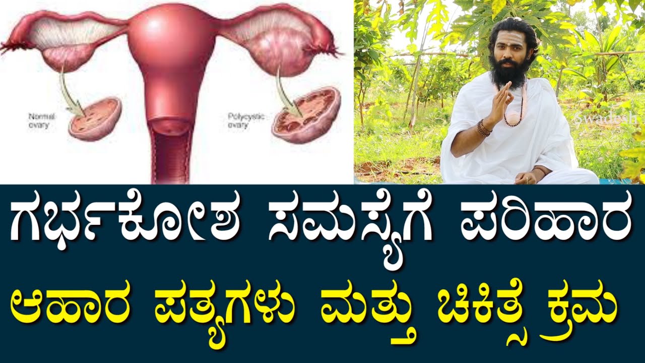 ಗರ್ಭ ಕೋಶ ಸಮಸ್ಯೆಗಳಿಗೆ ಮನೆ ಮದ್ದು ಮತ್ತು ಚಿಕಿತ್ಸಾ ಕ್ರಮ | PCOD, PCOS Problems and Salutions