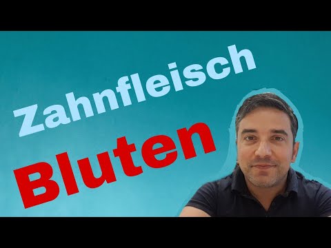 Video: Zahnfleischbluten - Gründe, Wie Man Aufhört, Wie Man Spült?