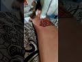 Tato Cicak