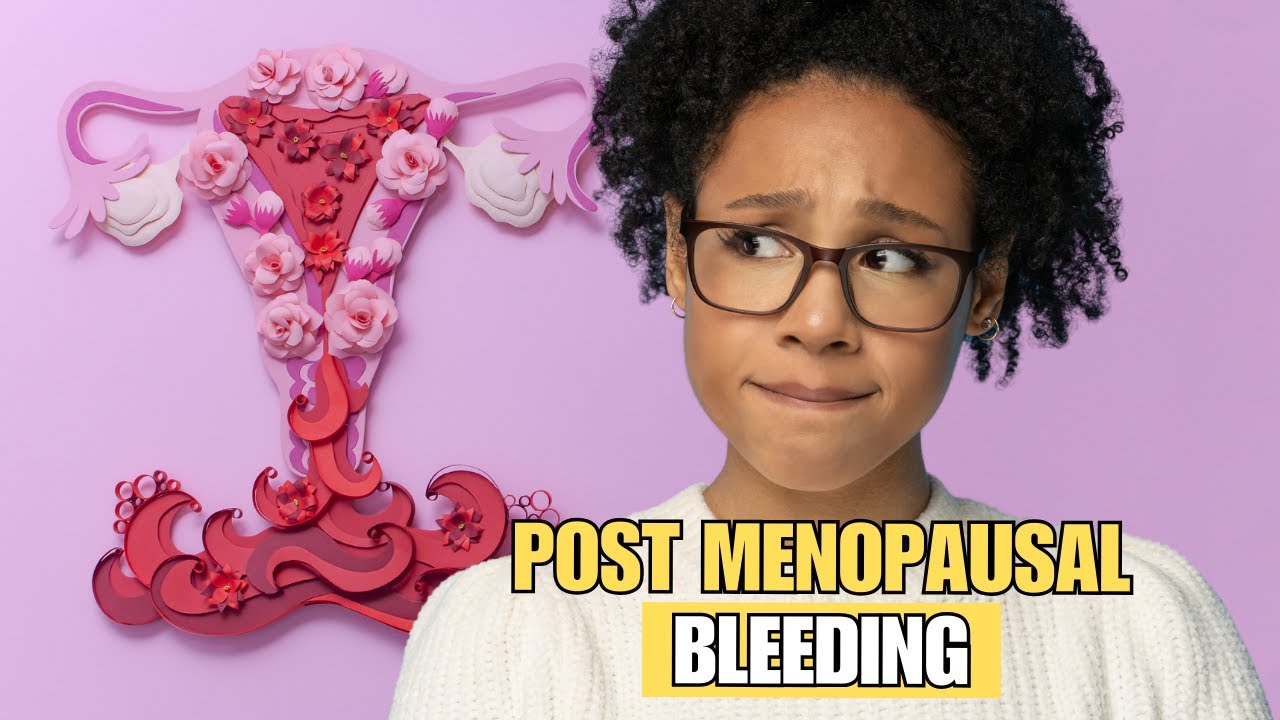 Exploring The Causes And Implications Of Post Menopausal Bleeding YouTube Exploring The Causes And Implications Of Post Menopausal Bleeding YouTube