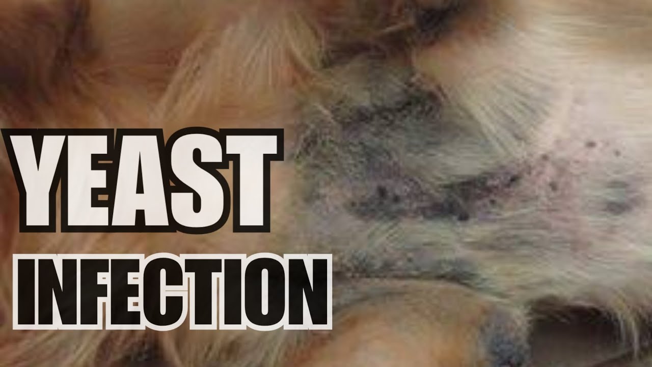 Yeast Infection. Signs And Symptoms, Diagnosis, Treatment And Home Remedies.