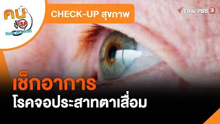 เช็กอาการโรคจอประสาทตาเสื่อม : CHECK-UP สุขภาพ