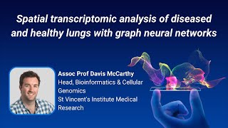 Famous Spatial transcriptomic analysis of diseased and healthy lungs with graph neural networks Net Worth