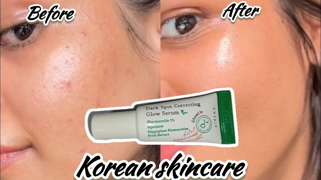 KOREAN SKINCARE | Axis-Y Dark Spots Correcting Glow Serum | Honest Review