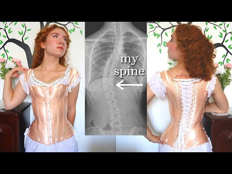 Video: Corset For Scoliosis - Indications, Pros And Cons, Types