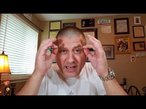 Mirroring Behaviors And Borderline Personality Disorder