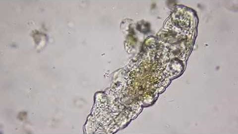 Tardigrade @ 400x magnification