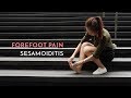 Forefoot Pain | Sesamoiditis - Podiatrist Georgina Tay, East Coast Podiatry