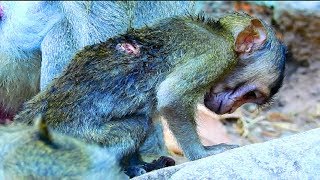 Emergency Poor Janna Very Weak Cos An Injure Not Better,Something Wrong On Back Side 1951