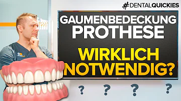 Wie hält eine Zahnprothese ohne Zähne?