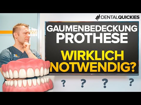 Video: 4 Möglichkeiten, eine Prothese zu tragen