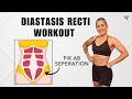 10 Min diastasis recti workout (fix ab separation) | safe & gentle exercises for postpartum