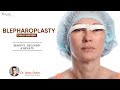 Blepharoplasty Eyelids surgery Explained: Benefits, Recovery, and Results - Dr Vikas Gawri