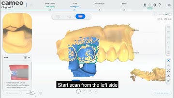 3 CAMEO Intraoral Scanner Elegant Ⅲ single crown scanning guidance video