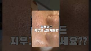 에스테틱 블랙헤드 꿀템 #루티너 #악센다 #블랙헤드 #피지관리 #광주피부관리 #광주에스테틱 #광주피부 #광주슈퍼젝션 #엘스킨광주