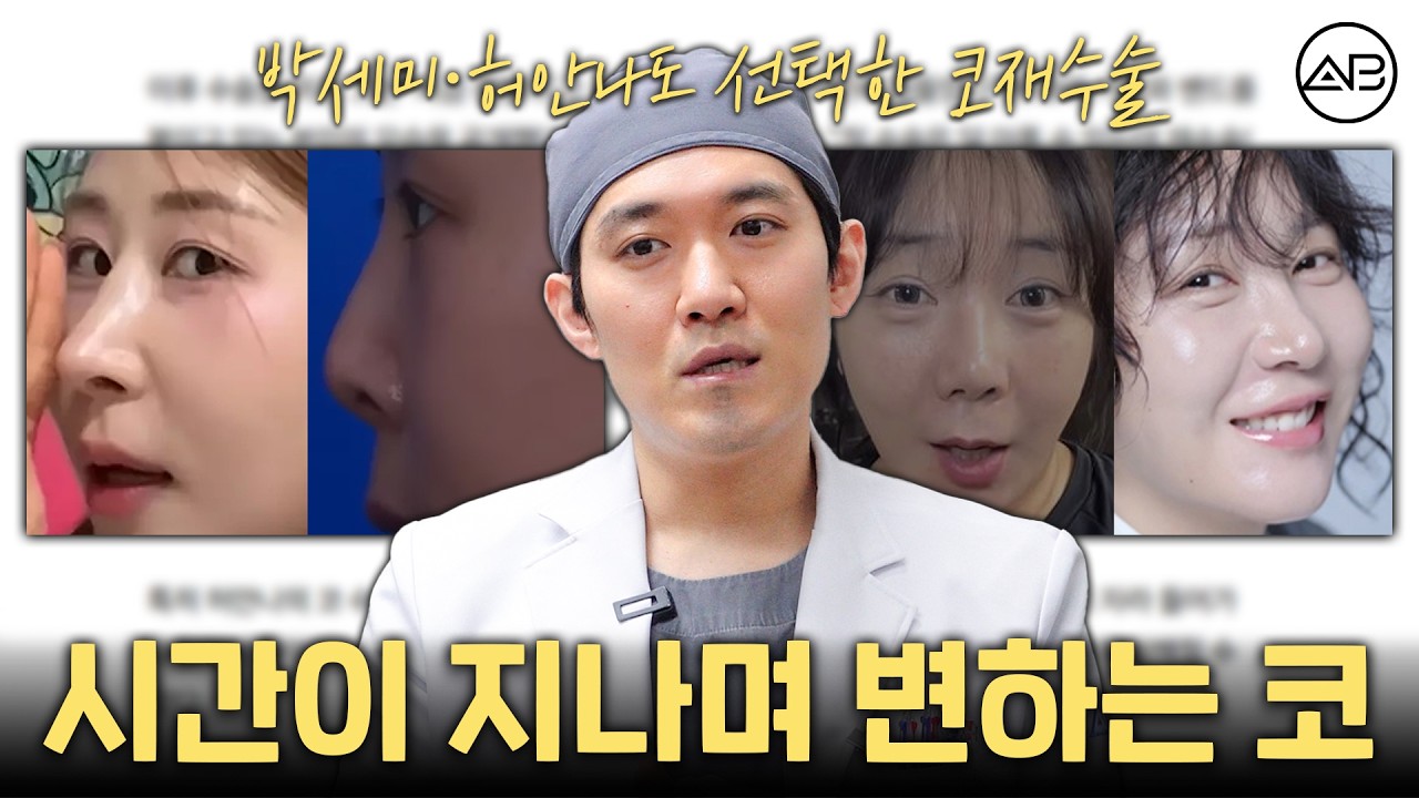 수술 직후엔 예뻤는데 왜 n년 뒤에 무너졌을까? 연예인 사례로 보는 보형물 변형과 코재수술 핵심