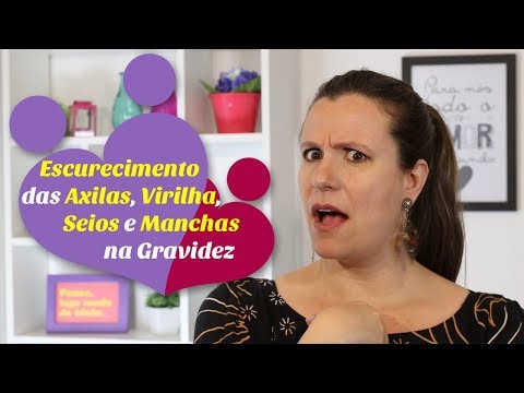 Vídeo: Pigmentação Após A Gravidez - Como Se Livrar?