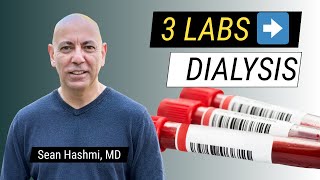 IgA Nephropathy: 3 Critical Labs Your Doctor May Not Be Tracking