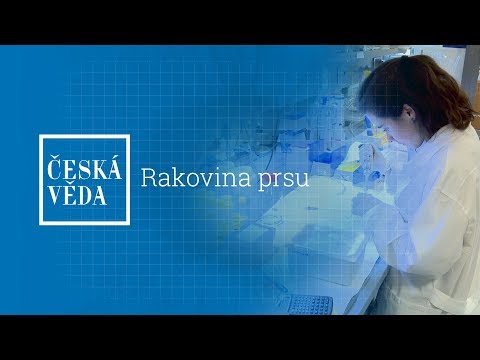 Video: Co Cítí Rakovina Prsu?