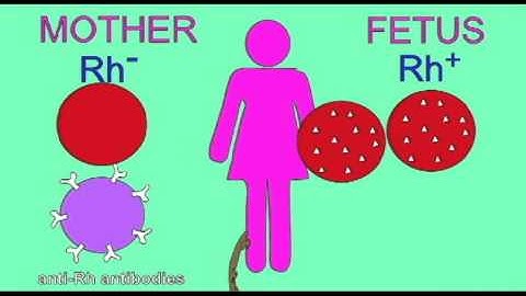 AP2 EXAM1: BLOOD: Rh FACTOR.avi