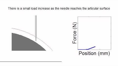 Cartilage thickness measurement with Biomomentum