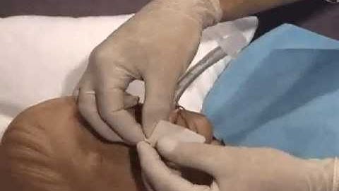 Bite Proof Bite Block