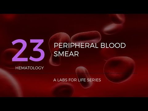 Part 1 - Preparation of Peripheral Blood Smear (PBS)