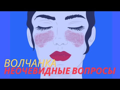 Системная красная волчанка: неочевидные вопросы