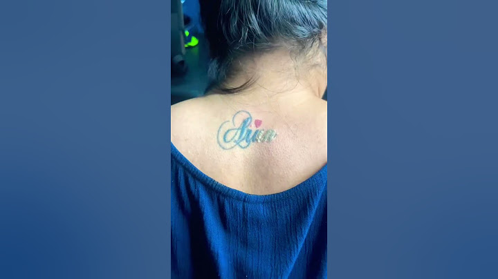 Laser tattoo removal | chennai tattoo hub | 8825680926