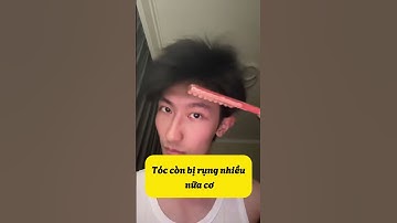 Team tóc rụng lả tả đâu ạ ☺️ #shorts #lamdep #virals #review #tips