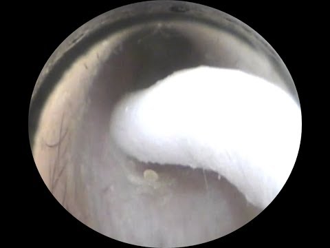 Vol.110【耳掃除】ＵＰ希望☆デンマークからの来店比較的キレイな耳～eariss