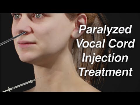 Vidéo: La paralysie des cordes vocales est-elle curable ?