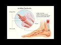 Fallen Arches and Other Foot Problems - Physical Therapy, Leesburg, VA
