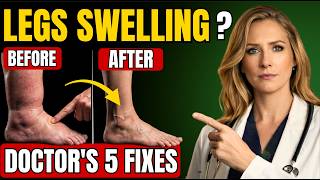 Leg Swelling? Your Heart May Be Warning You – 5 Signs Seniors Must Never Ignore screenshot 4