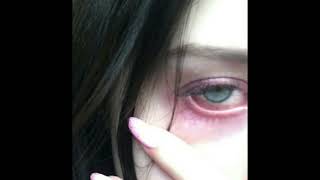 Asal  Headache sped Up