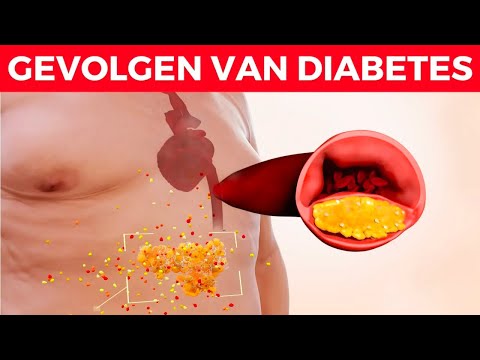 Video: 7 Langetermijndoelen Die Iedereen Met Diabetes Type 2 Moet Maken