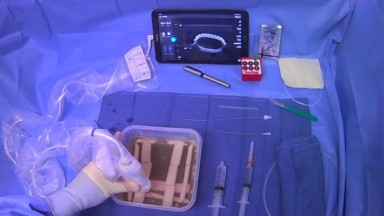 Ultrasound Scanning For Internal Jugular Vein Access - YouTube