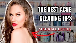 MY BEST CLEAR SKIN TIPS ALL IN ONE VIDEO (everything I've learned in 15 years)