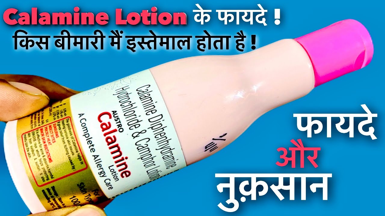 Calamine Lotion Ke Fayde In Hindi | Calamine Lotion