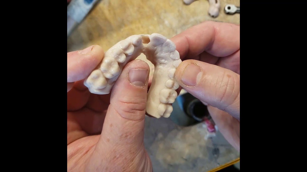 camera iphone 8 plus apk Controlling Your Implant Timing with Guided Surgery