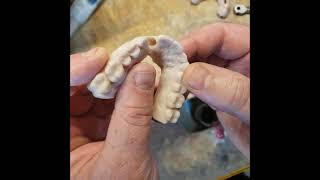 Controlling Your Implant Timing with Guided Surgery