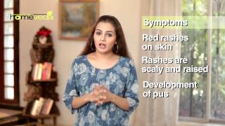 Skin Care - Jock Itch - Natural Ayurvedic Home Remedies