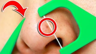 6 Clever Tricks To Unclog Pores INSTANTLY!