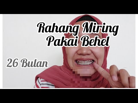 Video: Apakah kawat gigi meluruskan rahang?