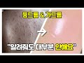 가슴, 등 피부 무조건 좋아지는, 7가지 등드름, 가드름 체크리스트 (따라면 하면 무조건 깨끗해집니다)