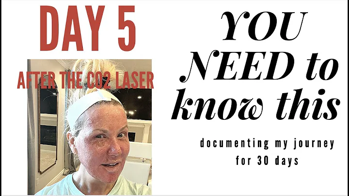 DAY 5- AFTER THE CO2 LASER. YOU NEED TO KNOW THIS-...
