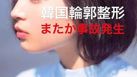 輪郭骨削り整形 韓国で人生をかけた大手術 最後まで見てください Mp3