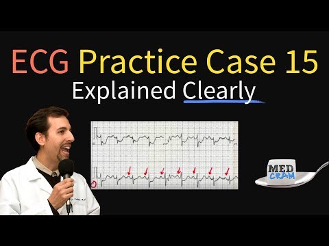 ECG / EKG Practice Case 15 - Step by Step Interpretation